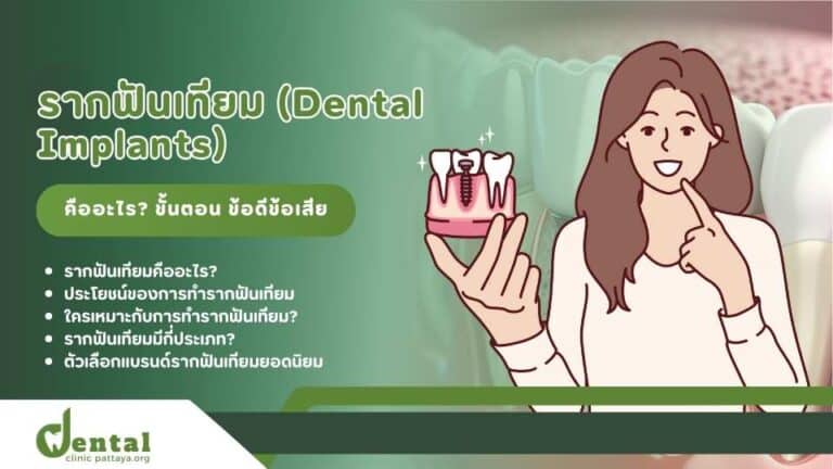 รากฟันเทียม คืออะไร มีข้อดีข้อเสีย อะไรบ้าง