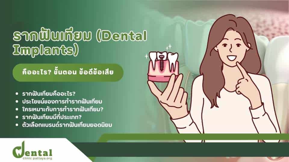 รากฟันเทียม คืออะไร มีข้อดีข้อเสีย อะไรบ้าง